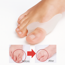 Bye Joanete™ – Alívio imediato e proteção diária 👣